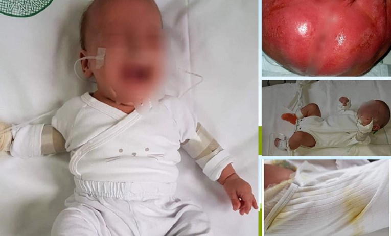 Inspekcija o bebama u zagrebačkoj bolnici: "Sve je po pravilima struke"